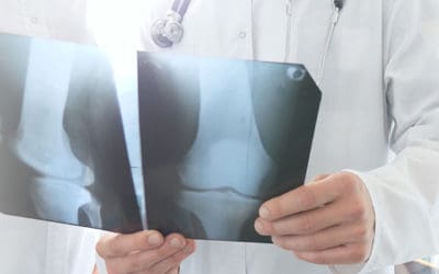 Unveiling the Advantages of Upgrading from X-Ray Film and CR Machines to Digital X-Ray