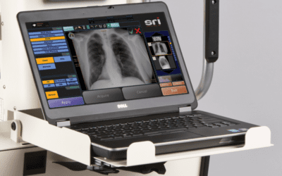 Revolutionizing Healthcare: Portable X-Ray Solutions