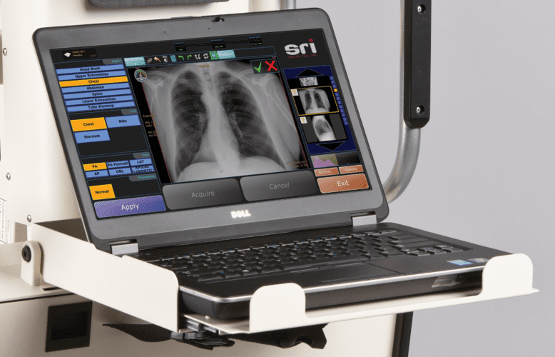 Portable X-ray Solutions