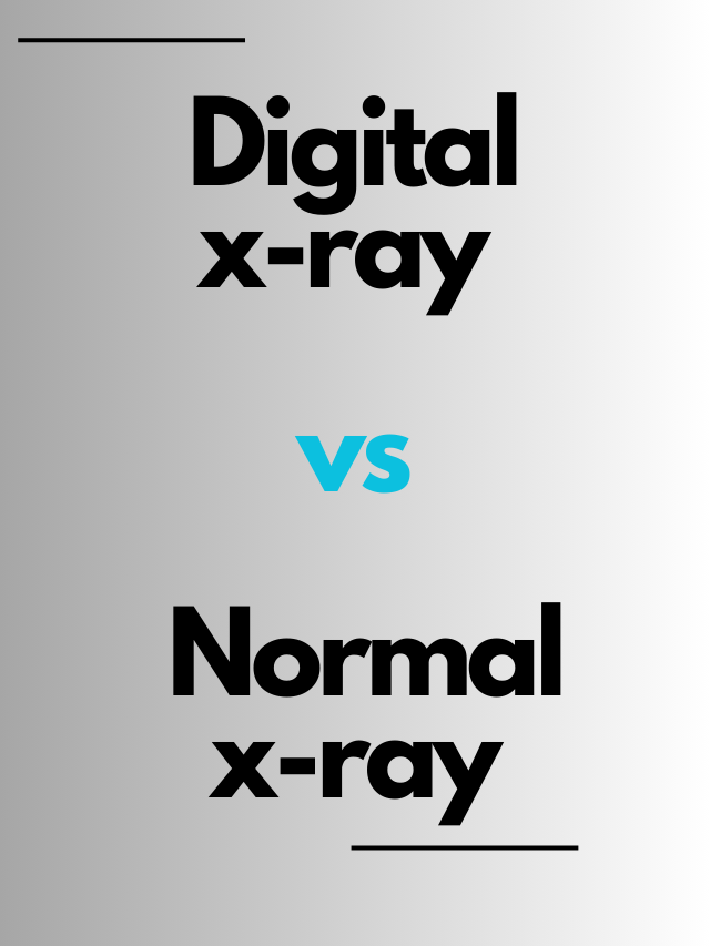 Digital x-ray vs Normal x-ray