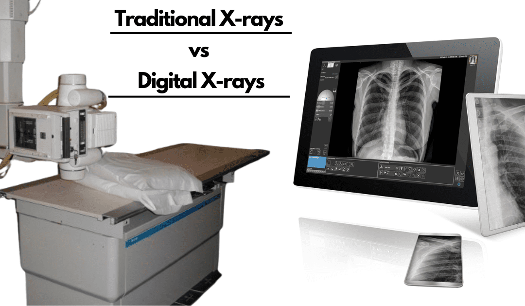 Traditional X-rays vs Digtal X-rays